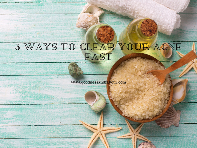 3 Ways to Clear Your Acne Fast